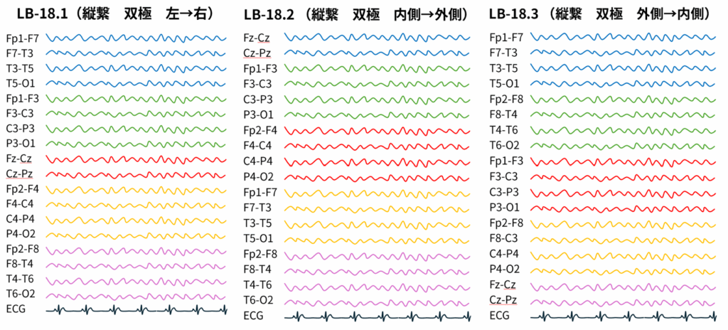 双極導出のモンタージュの波形の並び