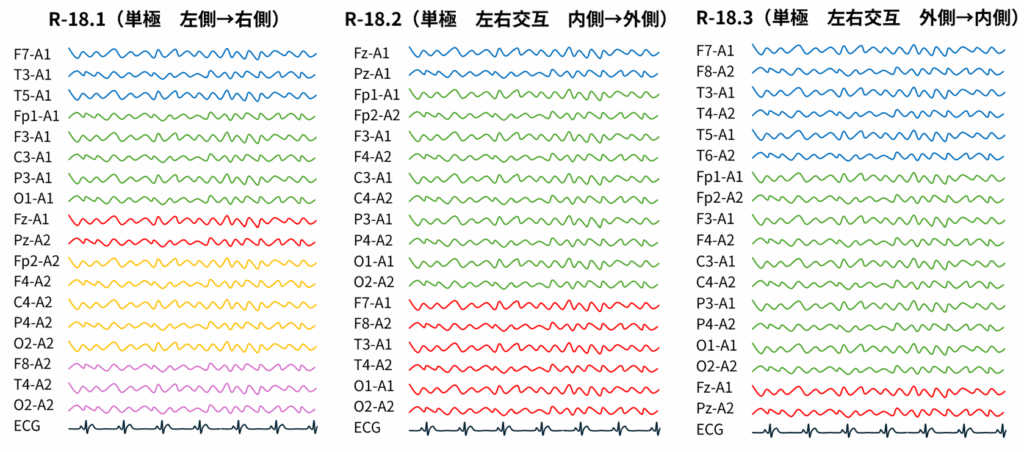 単極導出のモンタージュの波形の並び