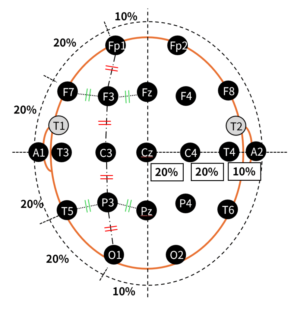10-20法での脳波の装着の上からみた図