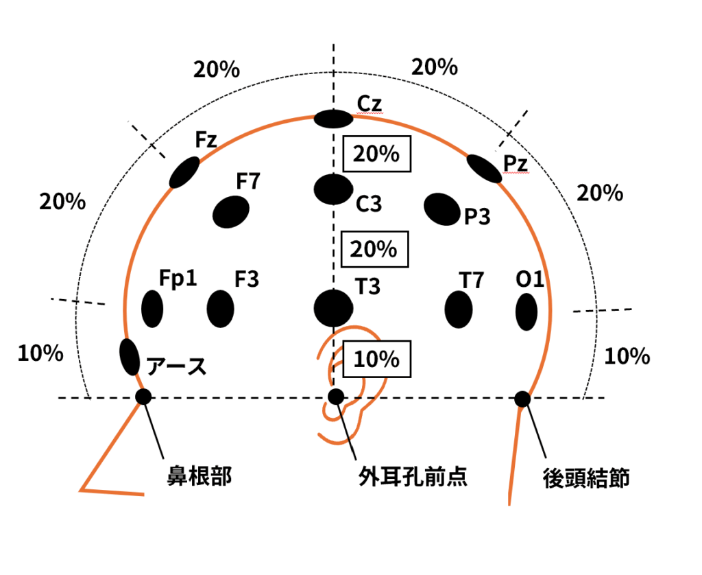 10-20法での脳波の装着の上からみた図