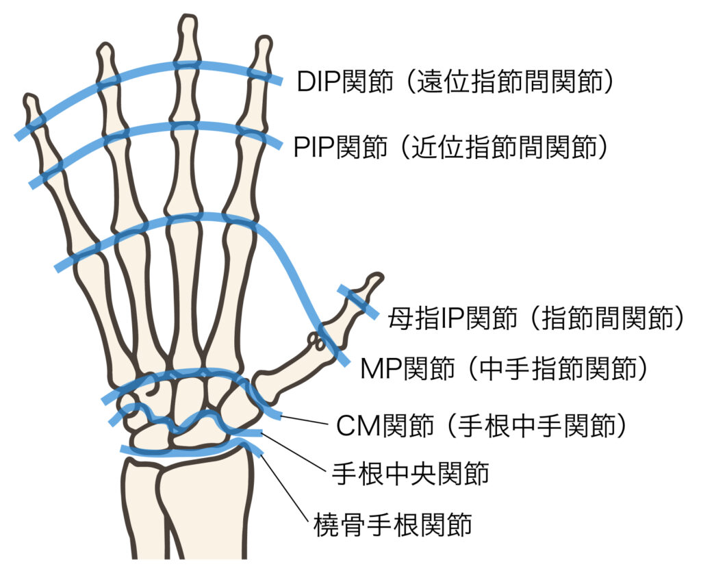 手の関節の模式図