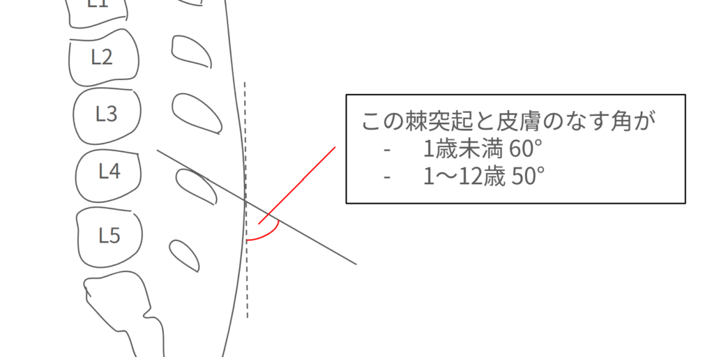 小児の棘突起の角度の図解
