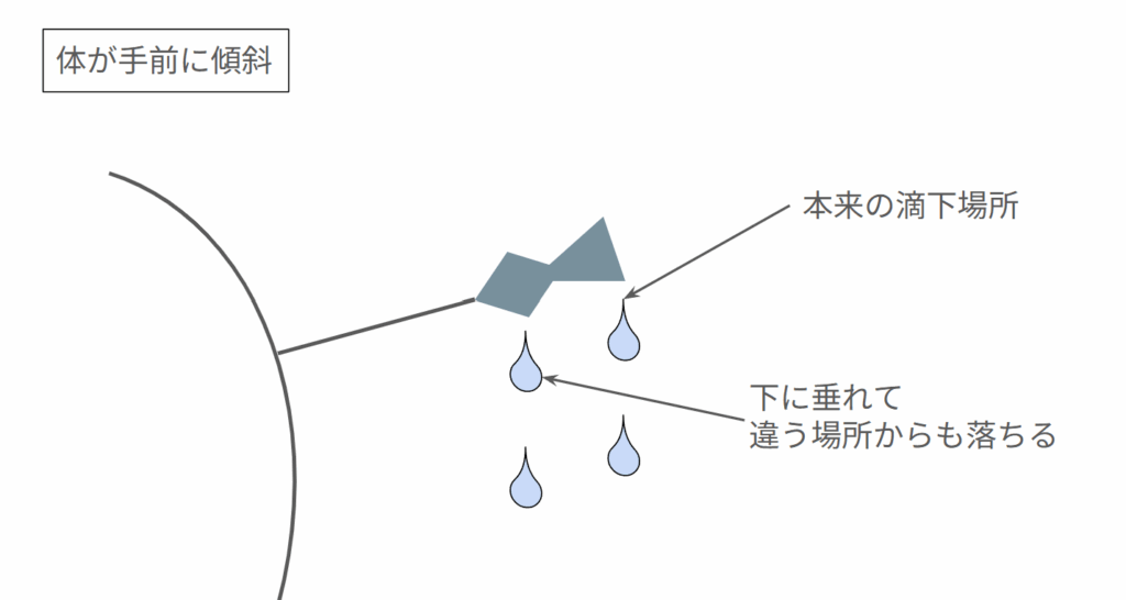 腰椎穿刺で体が抑える人側に向かって傾斜していることによるトラブルの図解