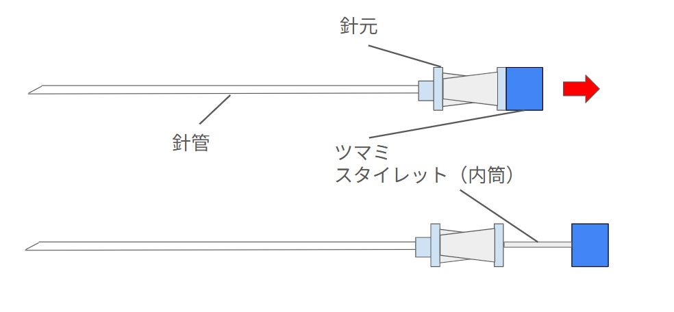 スパイラル針の細かい図解