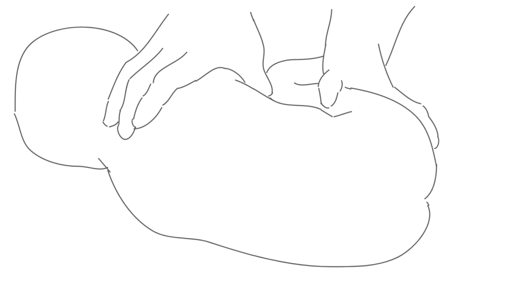 乳幼児の抑え方の図解