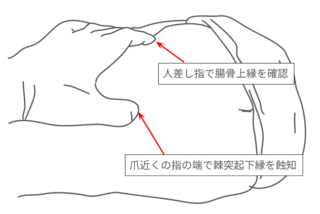 ヤコビー線の蝕知方法の図解