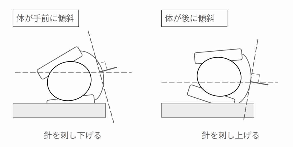 腰椎穿刺の姿勢(体が垂直になっていない場合の例)