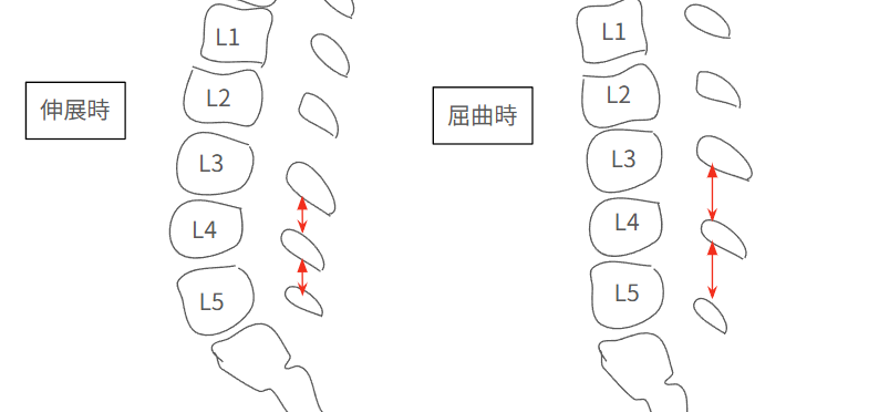 屈曲時の棘突起の間が開く図解