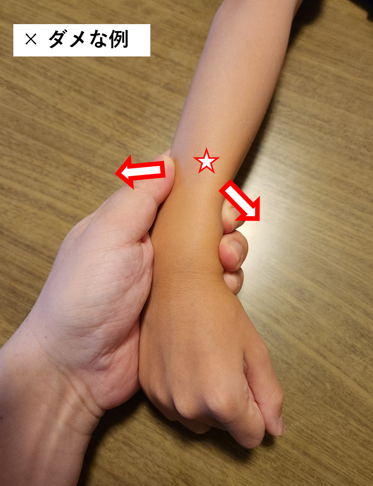 穿刺をする際のテンションのかけ方の悪い例.