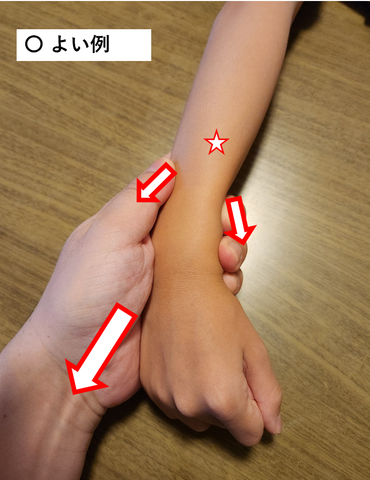 点滴をする際のテンションのかけ方の良い例