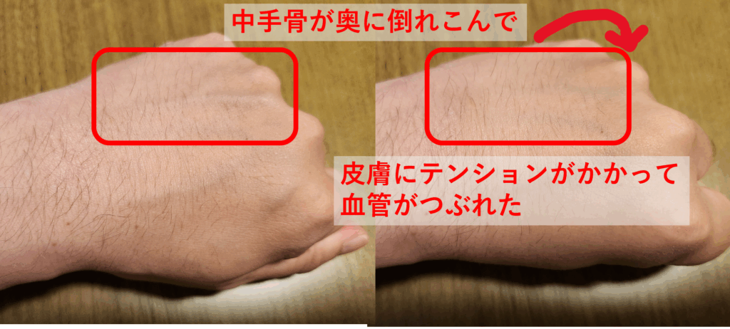 手を握りこんだ時の手背の血管の動き
