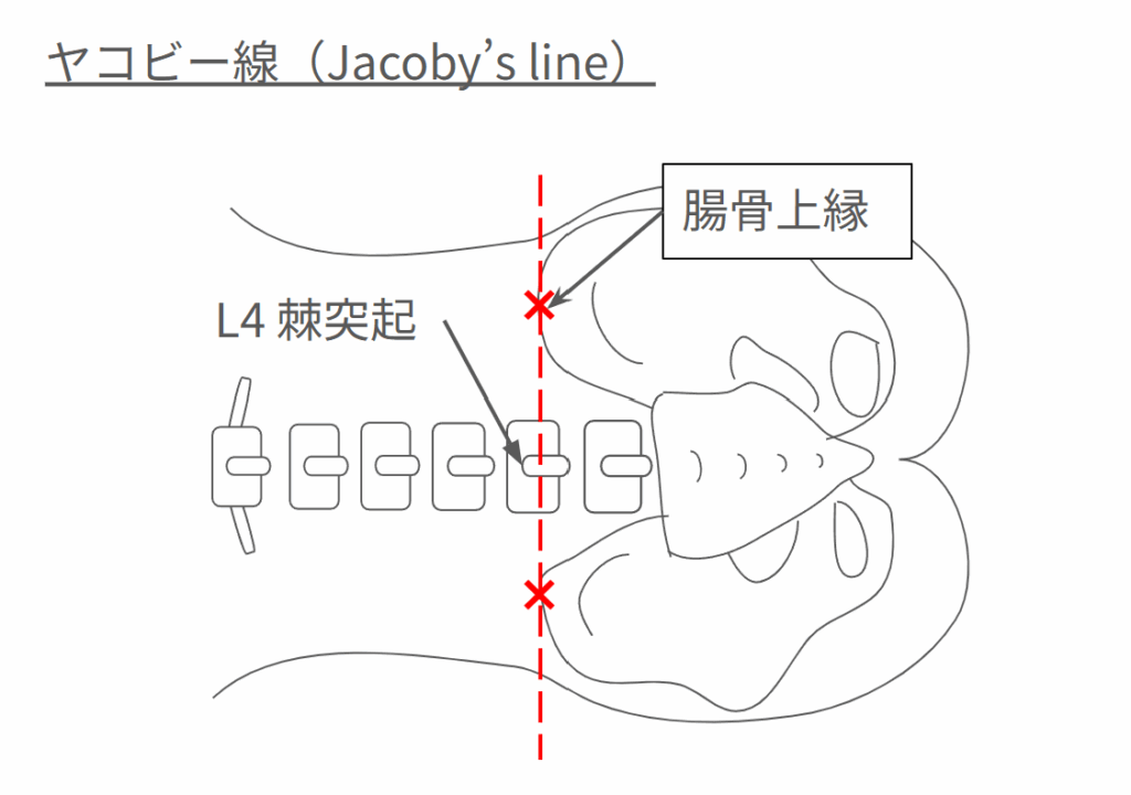 ヤコビー線の説明図